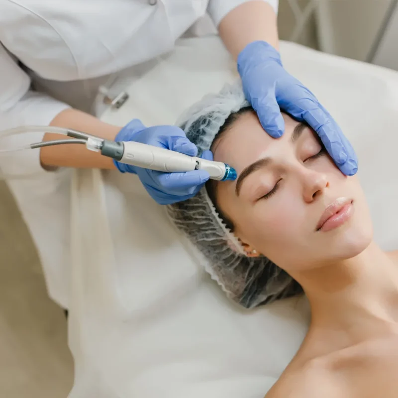 Hydrafacial Elite